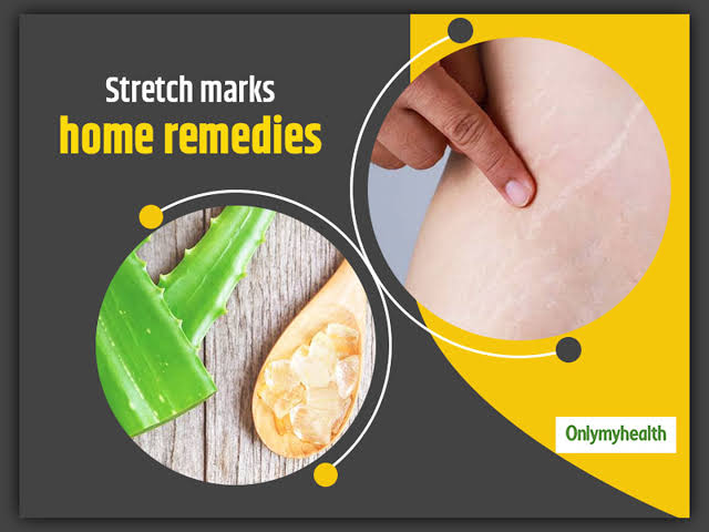 https://carebeautyco.com/5-effective-ways-to-get-rid-of-stre